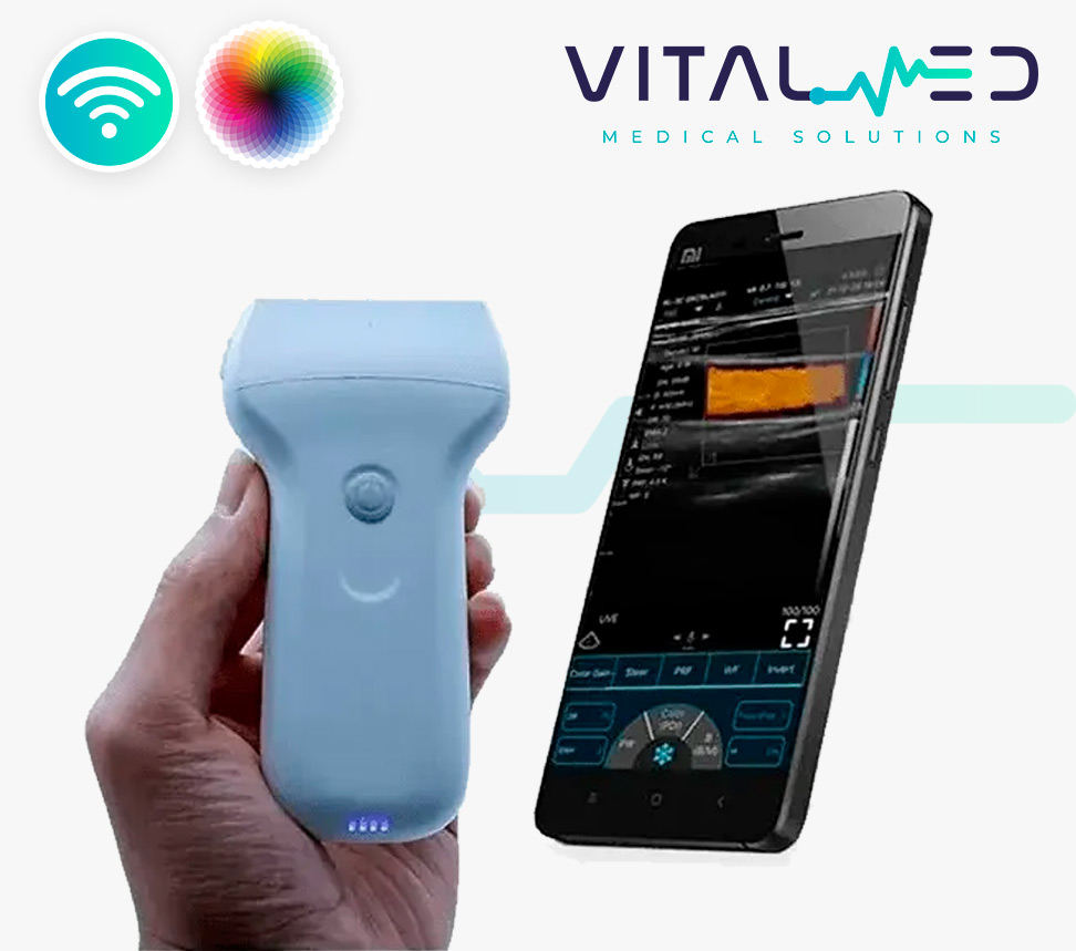 Ultrasonido Wifi Doppler Color